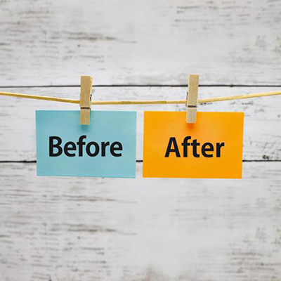 ガミースマイルの治療事例