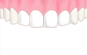 治療イメージafter