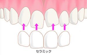 治療イメージbefore
