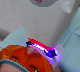 ホワイトニング