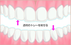 透明のトレーを被せる