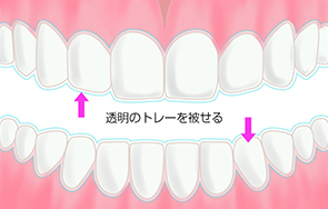 透明のトレーを被せる