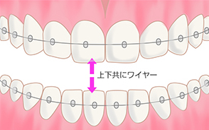 治療イメージafter
