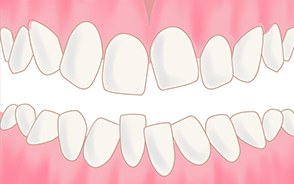治療イメージbefore