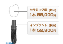 シンプルインプラント(ワンピース)