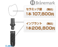 Branemarkインプラント(ツーピース)